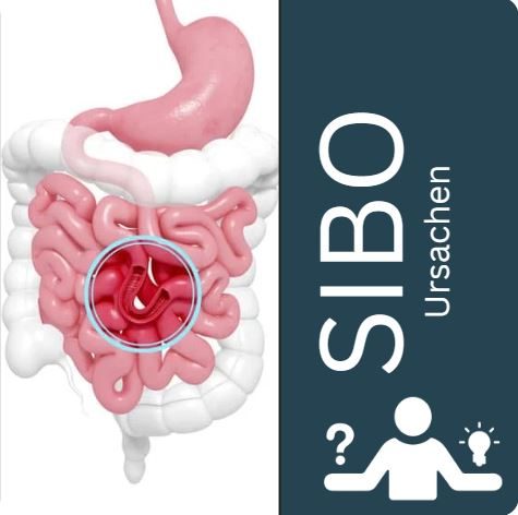 Possible cause of SIBO: Impaired flow through the small intestine