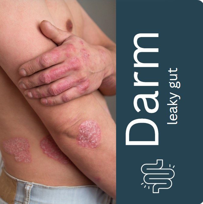 Leaky Gut and skin